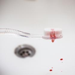 Zahnfleisch Zahnbürste Blut im Waschbecken