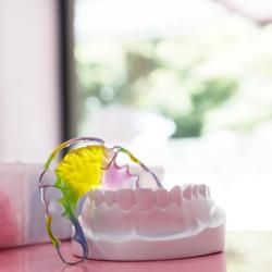 Retainer zur Stabilisierung der Zähne