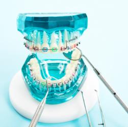 Zahnspangenmodell mit Behandlungsinstrumenten