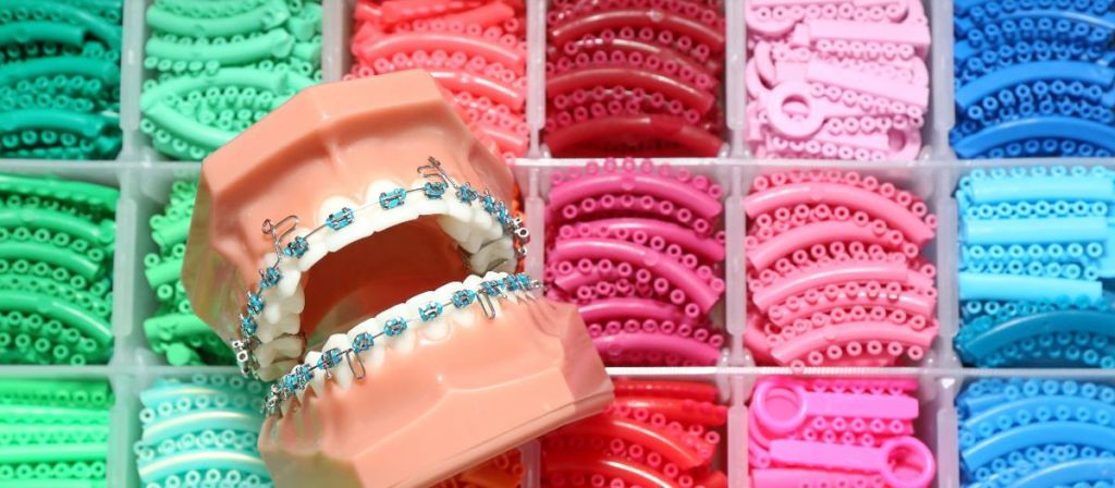 Modell einer Zahnspange mit Bändern in vielen Farben