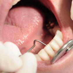Kontrolle von Zähnen und Zahnfleisch