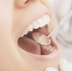 Untersuchung beim Zahnarzt mit Mundspiegel