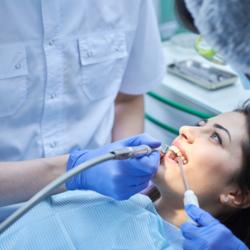 Politur der Zähne bei junger Patientin