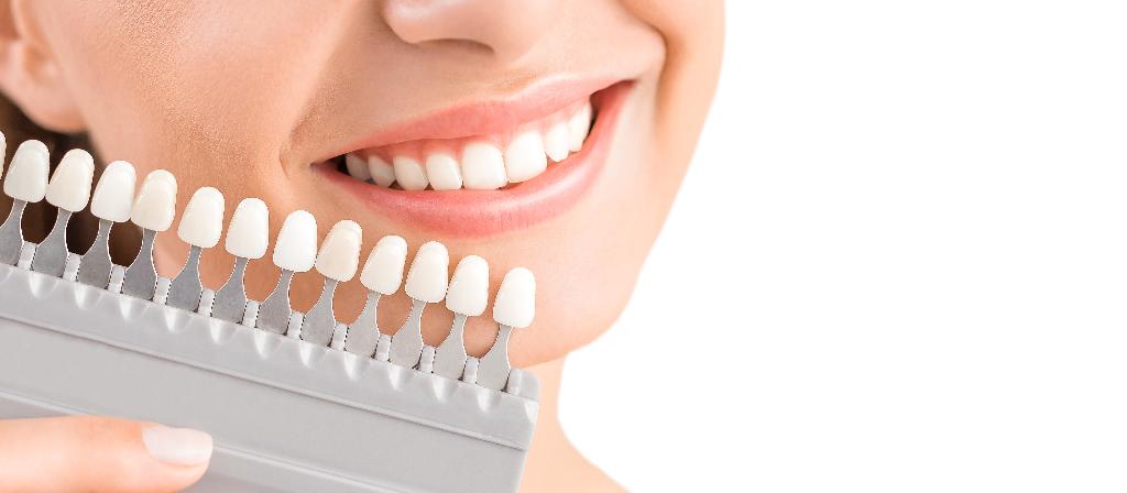 Ästhetische Zahnmedizin Veneers Bleaching